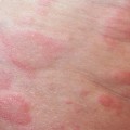 Are You Allergic to Pet Dander? Here's How to Find Out